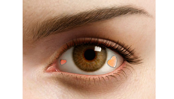 Implantes de joyas en los ojos