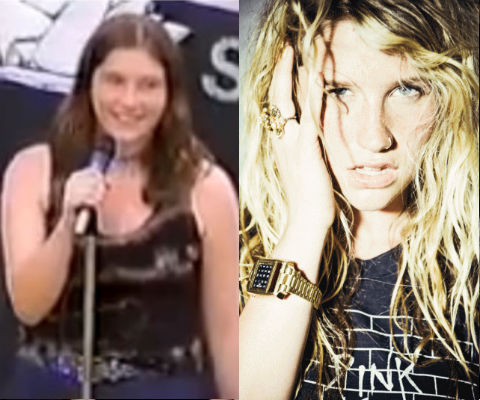 Kesha antes y después