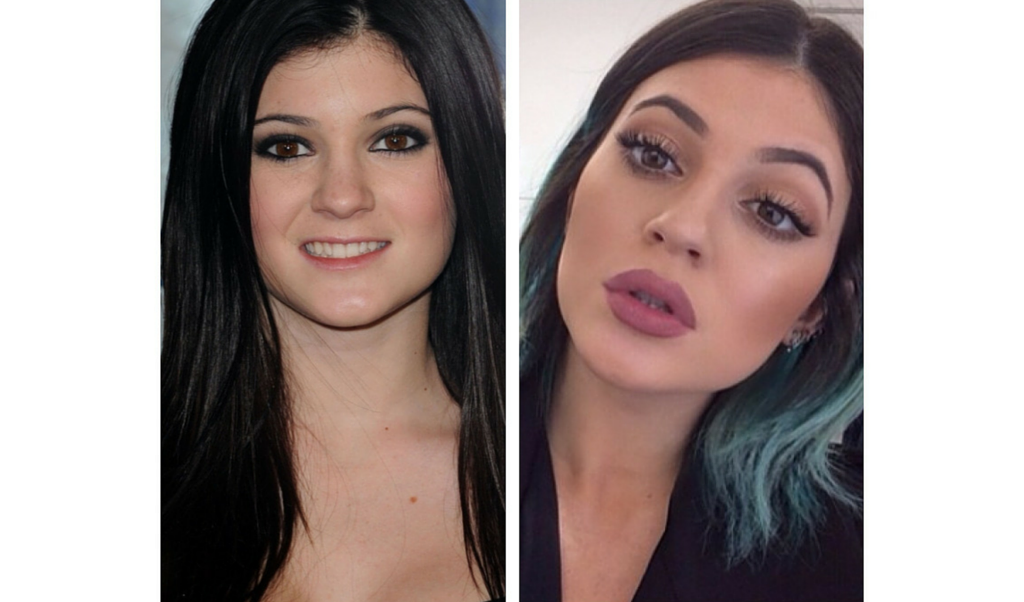 kylie Jenner antes y después