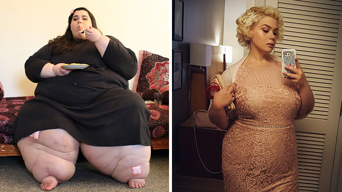 Mujeres con obesidad mórbida que cambiaron totalmente de aspecto