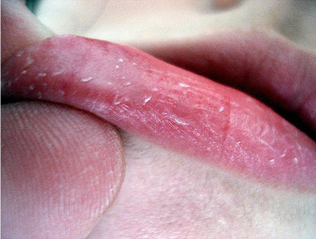 Cómo acabar de una vez por todas con los labios agrietados 