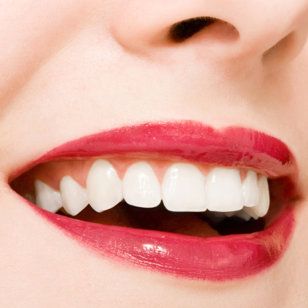 Dos trucos para conseguir lucir unos dientes más blancos en cuestión de minutos 