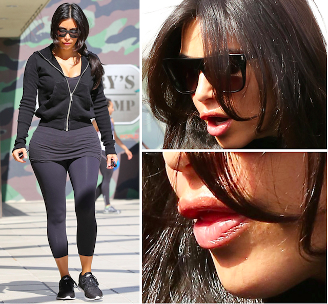 ¿Se ha vuelto a operar Kim Kardashian?