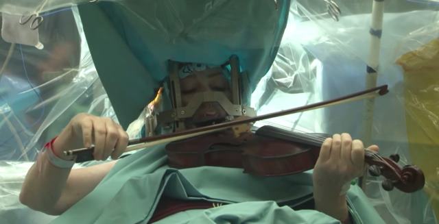 violin operacion cerebro