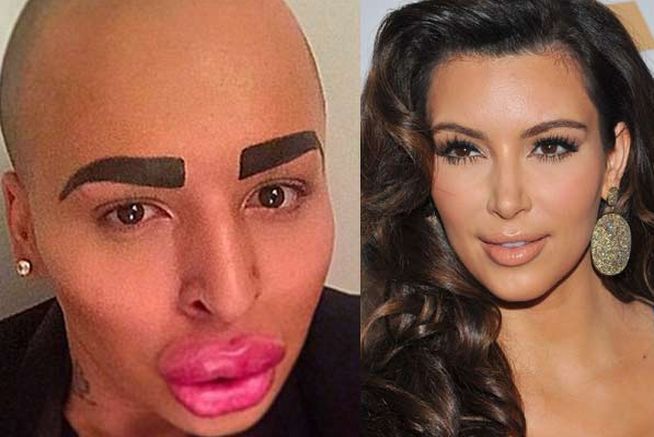 chico se opera para parecerse a Kim Kardashian