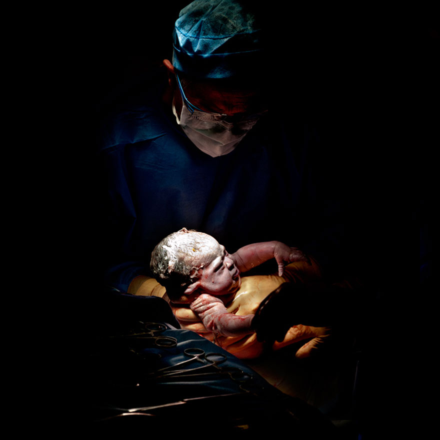 Las fotos más impactantes de recién nacidos