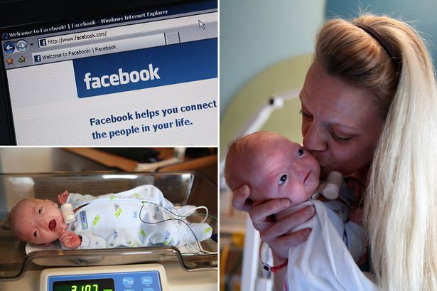 Facebook censura las fotos del bebé que nació sin nariz