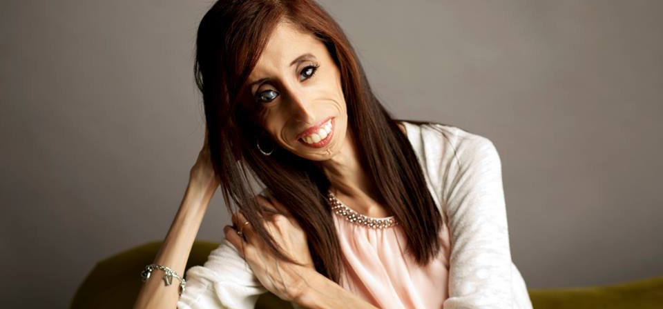 LIZZIE VELASQUEZ la mujer mas fea del mundo