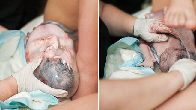 Las impactantes fotos de partos de esta fotógrafa dan la vuelta al mundo