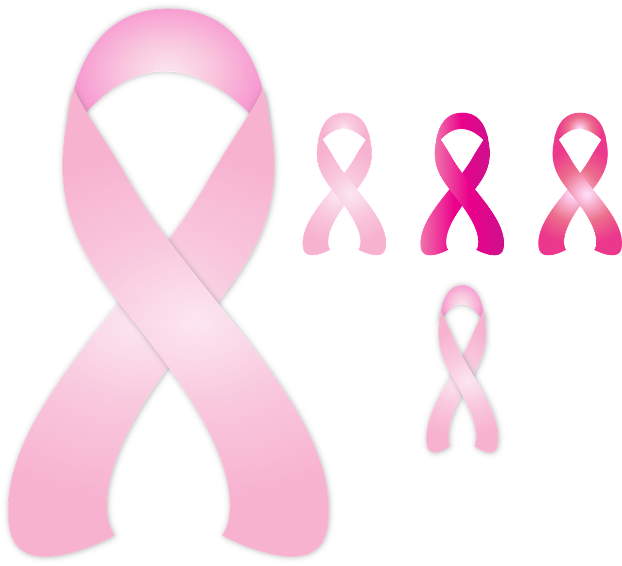 ¿Cómo se presenta el cáncer de mama?