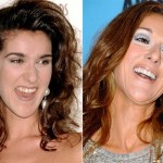 Los dientes de los famosos tienen un pasado