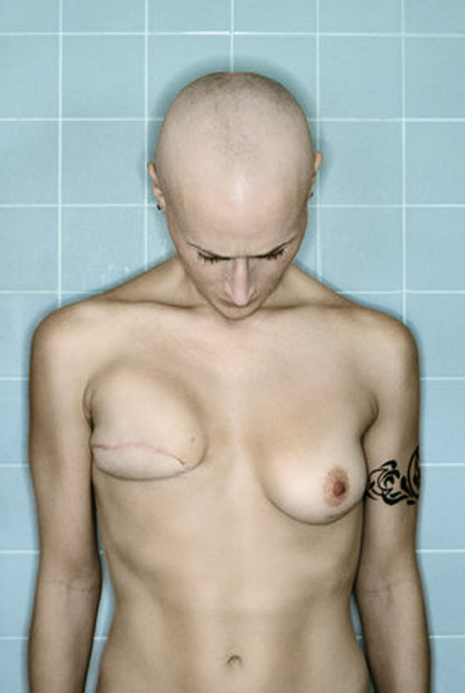 fotógrafa documenta su cáncer