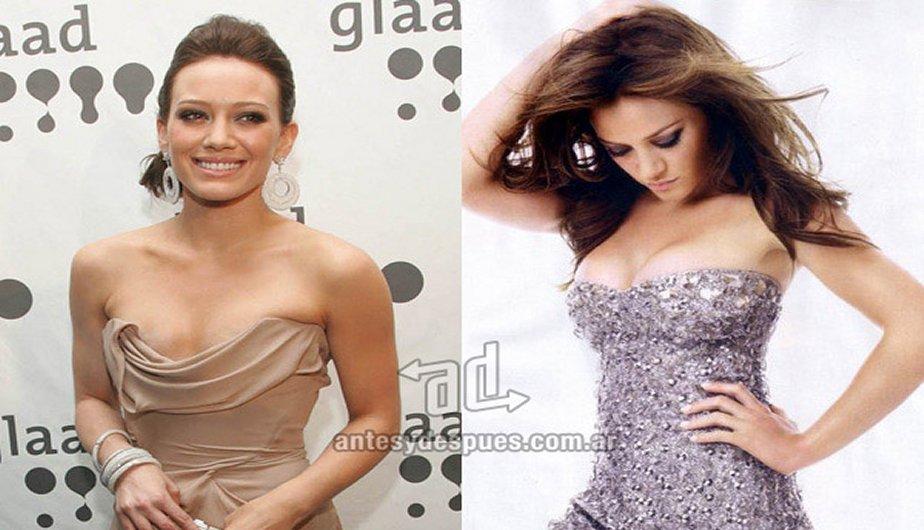 Famosas con pechos operados