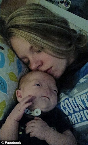 Eli Thompson, bebé sin nariz