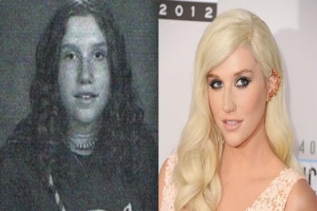 Kesha antes y después