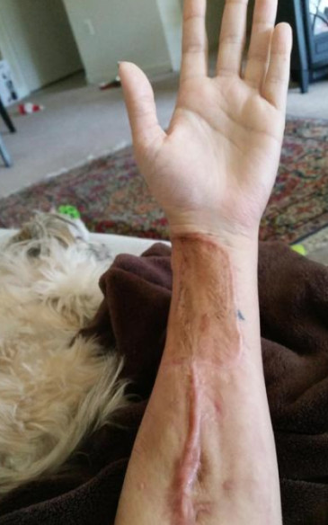 Tatuaje en la lengua de Harry Potter