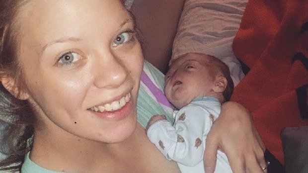 Eli Thompson, bebé sin nariz