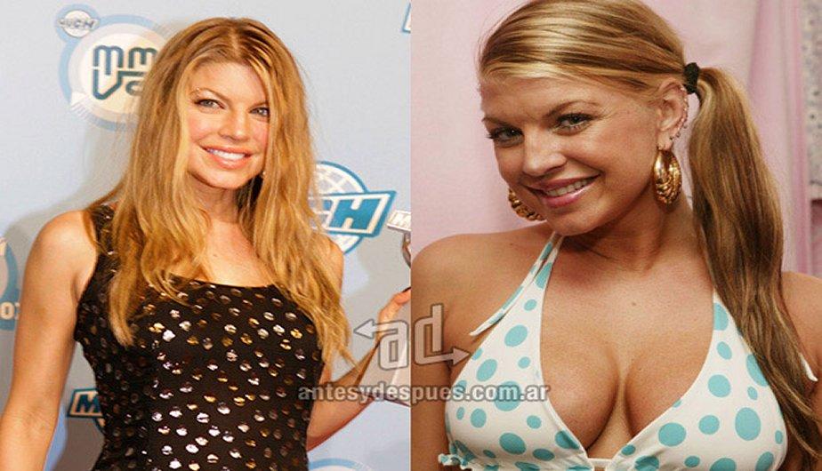 Famosas con pechos operados
