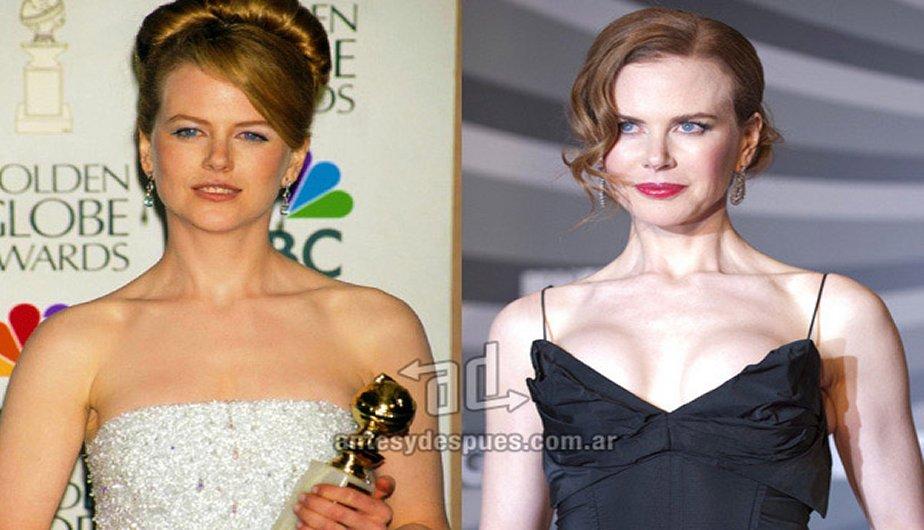 Famosas con pechos operados