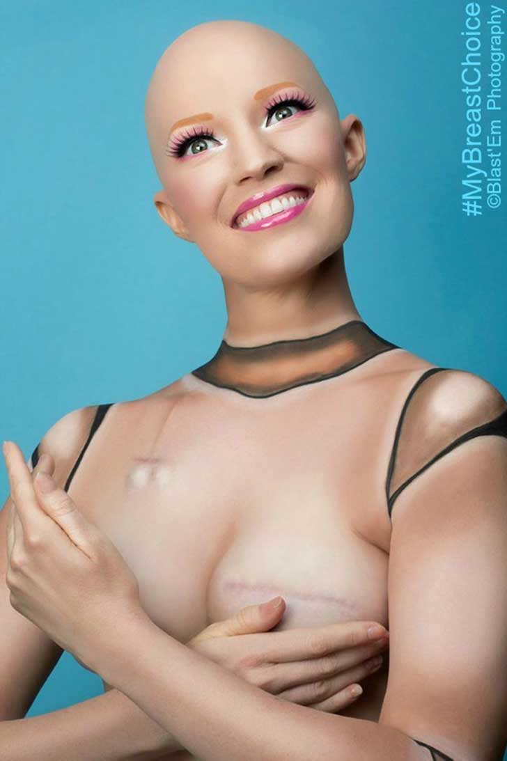 Documenta su cáncer de mama con humor