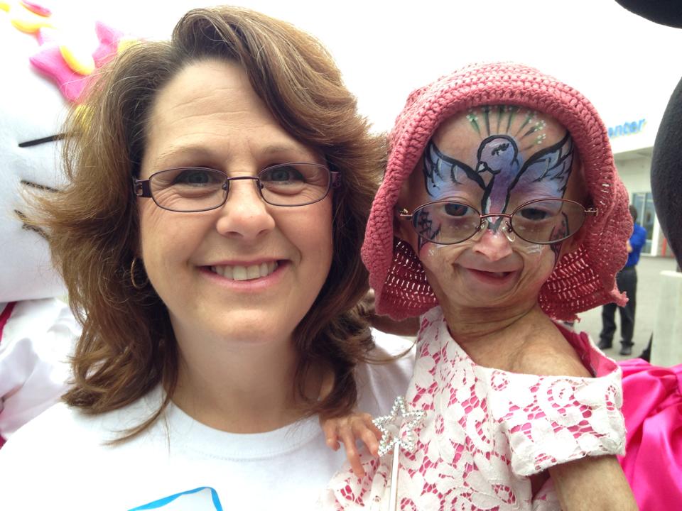 Adalia Rose, niña con envejecimiento prematuro