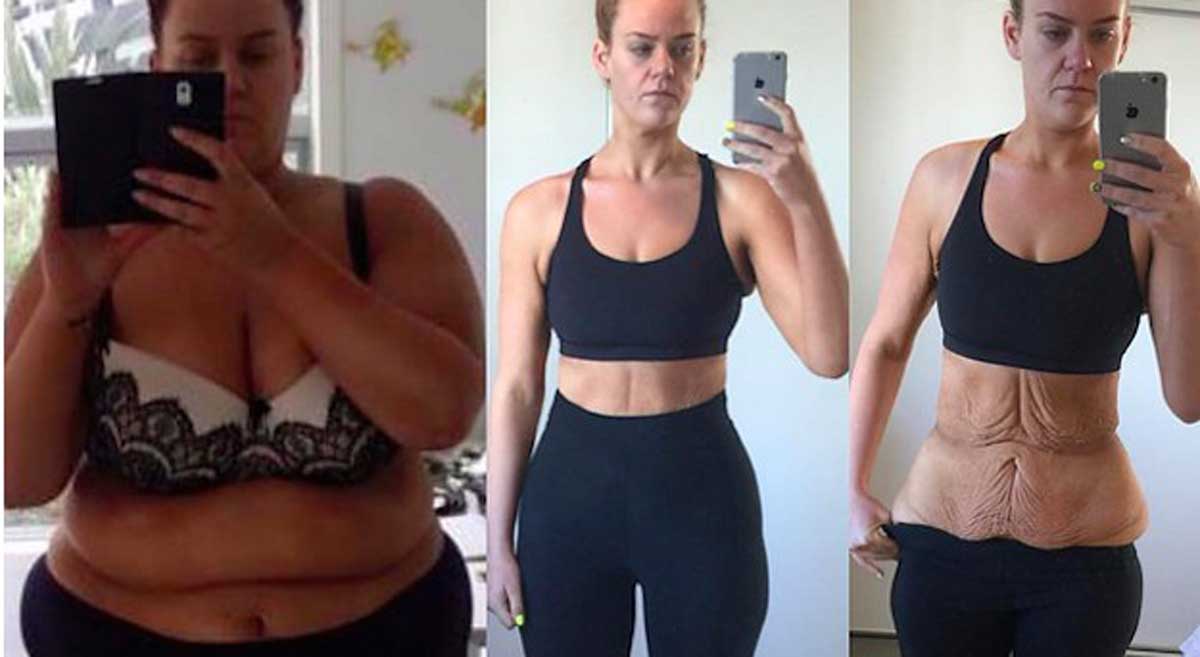 Antes y después de Simon Andersen