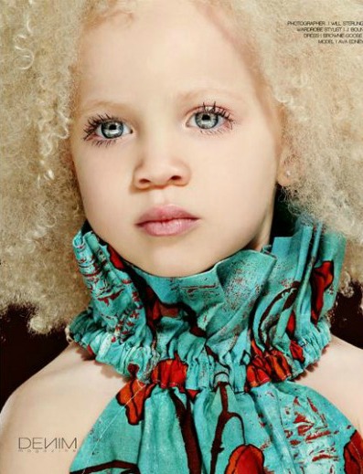 La niña negra albina que arrasa en las revistas de moda | Estarguapas