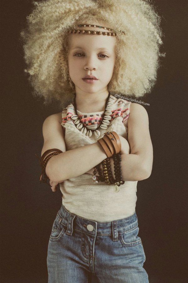 Ava Clarke, niña modelo negra albina