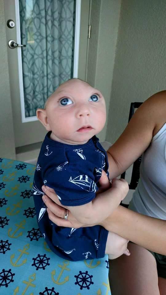 Jaxon Buell, el bebé sin cráneo ni cerebro