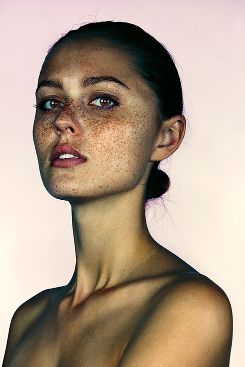 Brock Elbank, retratos de personas con pecas