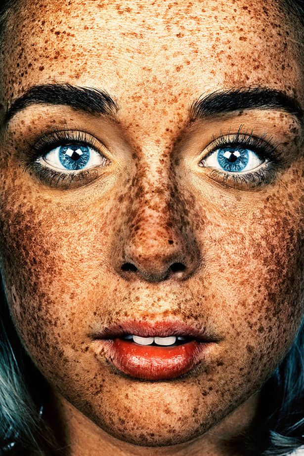Brock Elbank, retratos de personas con pecas