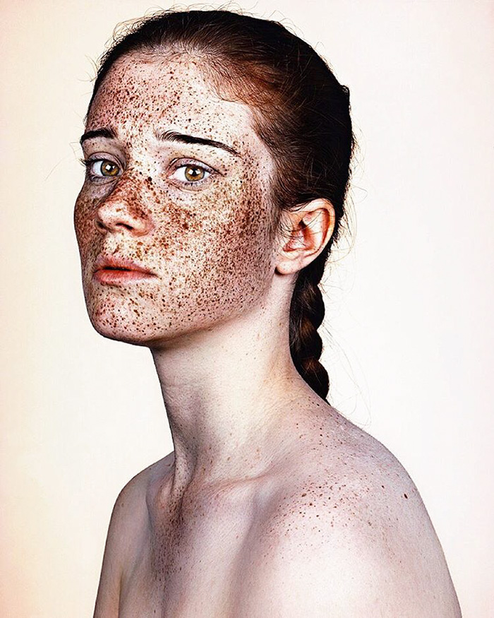 Brock Elbank, retratos de personas con pecas