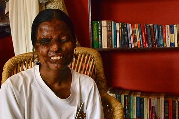 Cafetería de víctimas de los ataques de ácido 