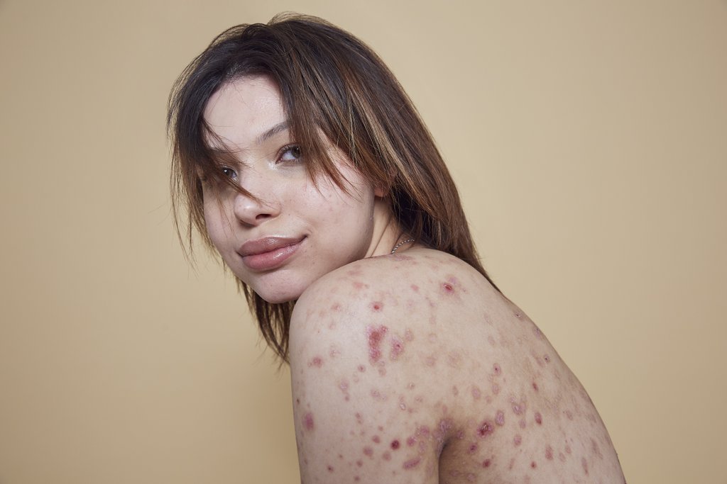 Campaña de Missguided #InYourOwnSkin