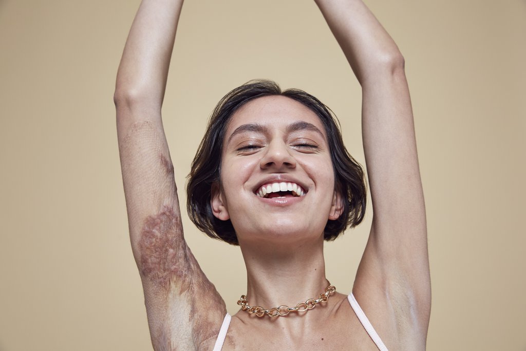 Campaña de Missguided #InYourOwnSkin