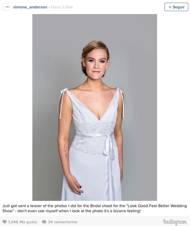 Antes y después de Simon Andersen