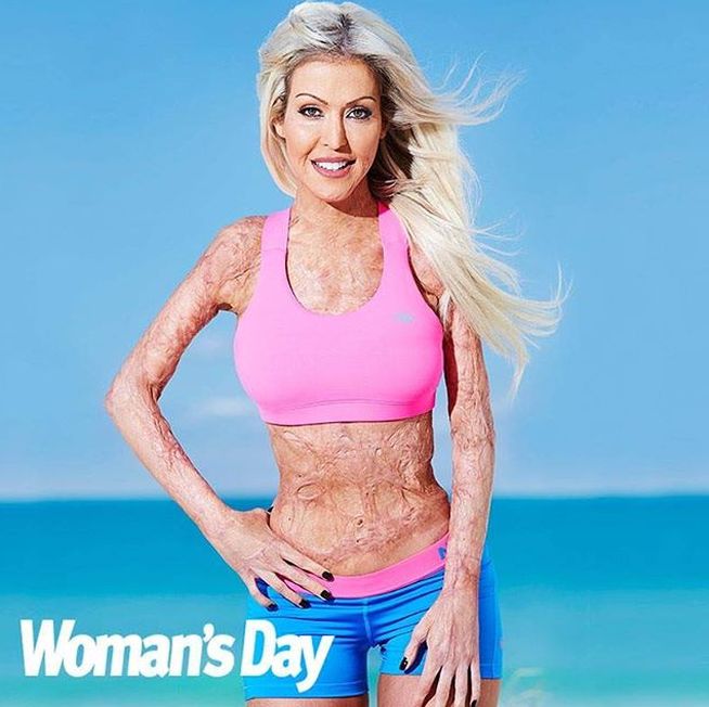 Dana Vulin, quemada viva por celos