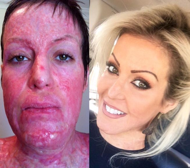 Dana Vulin, quemada viva por celos