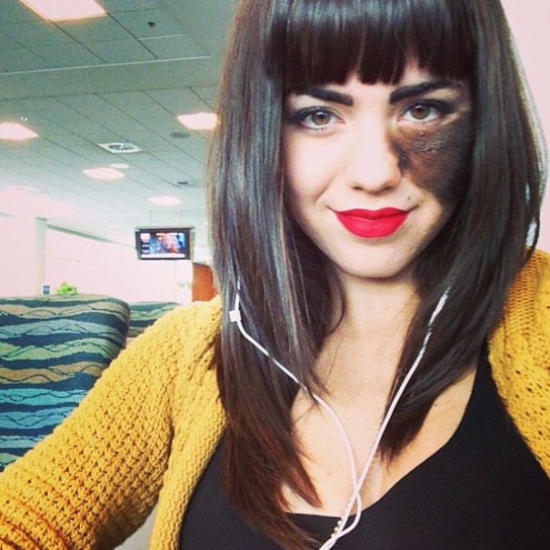 Cassandra, la chica con la mancha en la cara