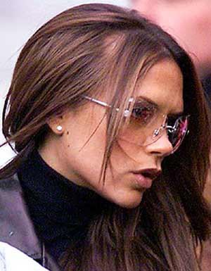 Famosas con alopecia 