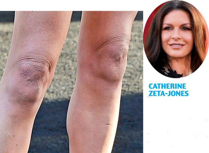 famosas con rodillas feas