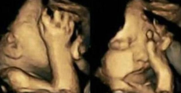 Fetos de madres fumadoras 