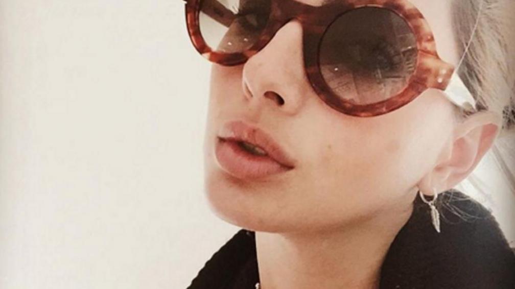 Famosas haciendo fish gape