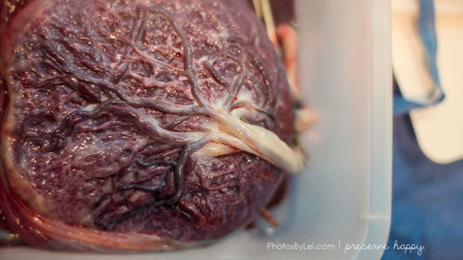 Fotos de partos de Leilani Rogers