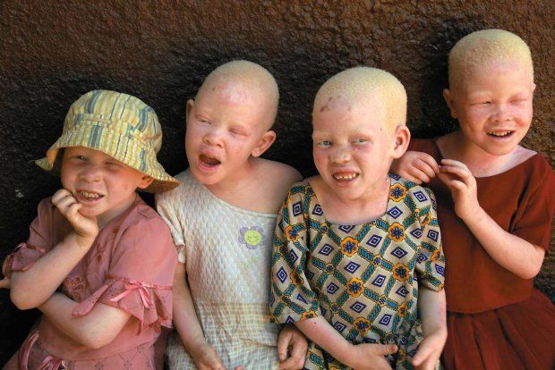 Fotos de Rick Guidotti 