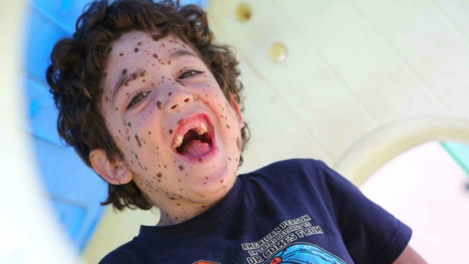 Fotos de Rick Guidotti 