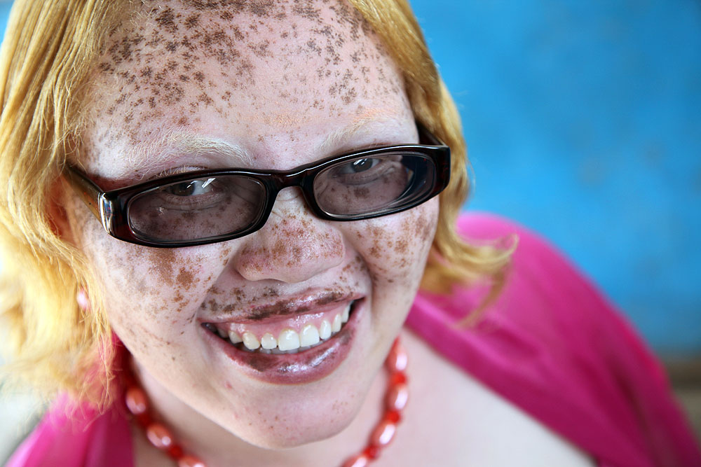 Fotos de Rick Guidotti 