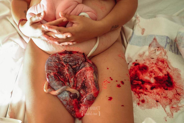 Fotógrafa fotografía a madres con sus placentas