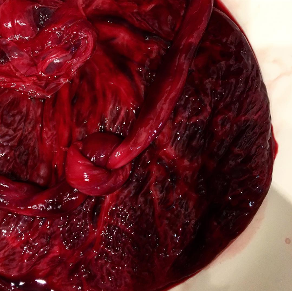 Fotógrafa fotografía a madres con sus placentas