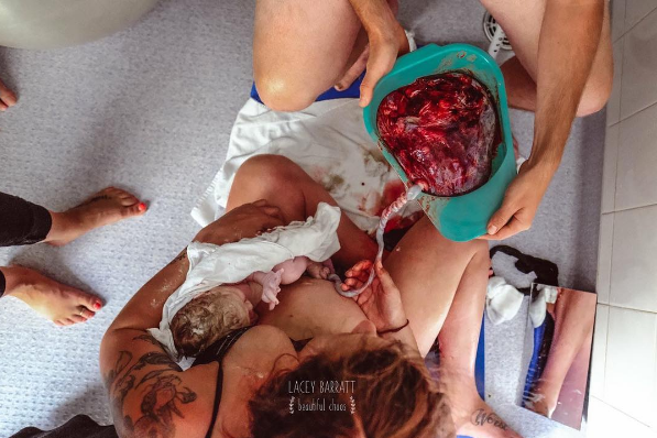 Fotógrafa fotografía a madres con sus placentas